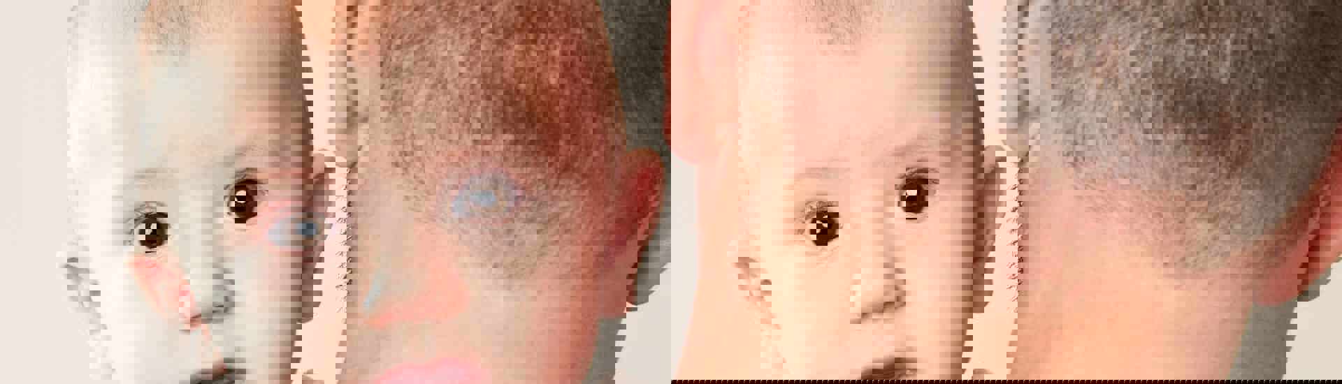 Baby heeft last van reflux